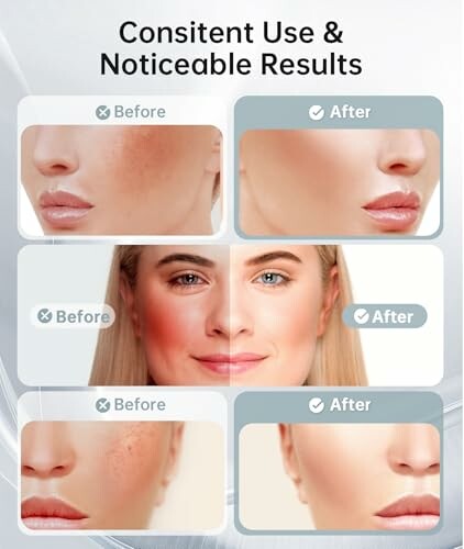 Comparison of facial skin before and after skincare treatment.