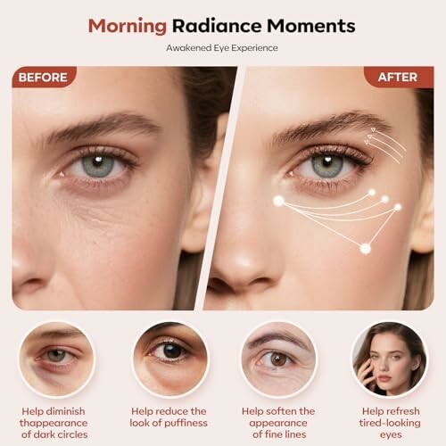 Before and after eye treatment comparison showing reduced dark circles, puffiness, and fine lines.