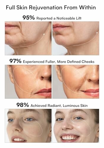 Before and after images showing skin rejuvenation results with noticeable lift, fuller cheeks, and radiant skin.