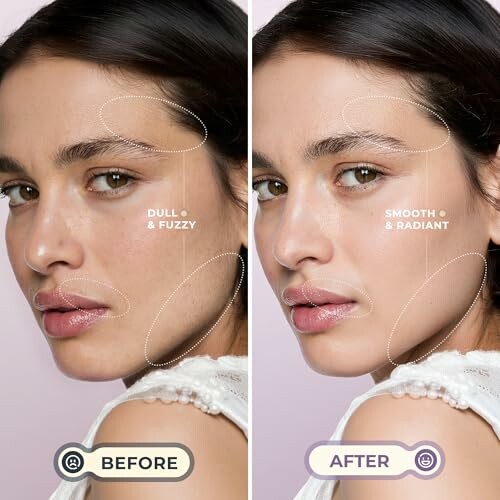 Before and after skincare comparison showing improved skin texture.